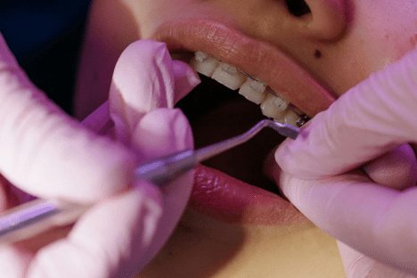 What Orthodontists Wish Every Patient Knew About Braces